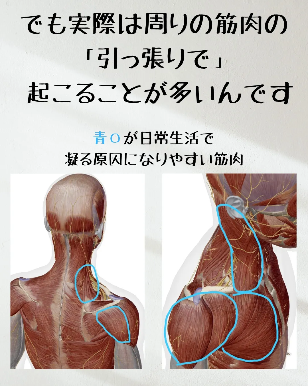 ≪肩こりはなぜ起こるのか≫