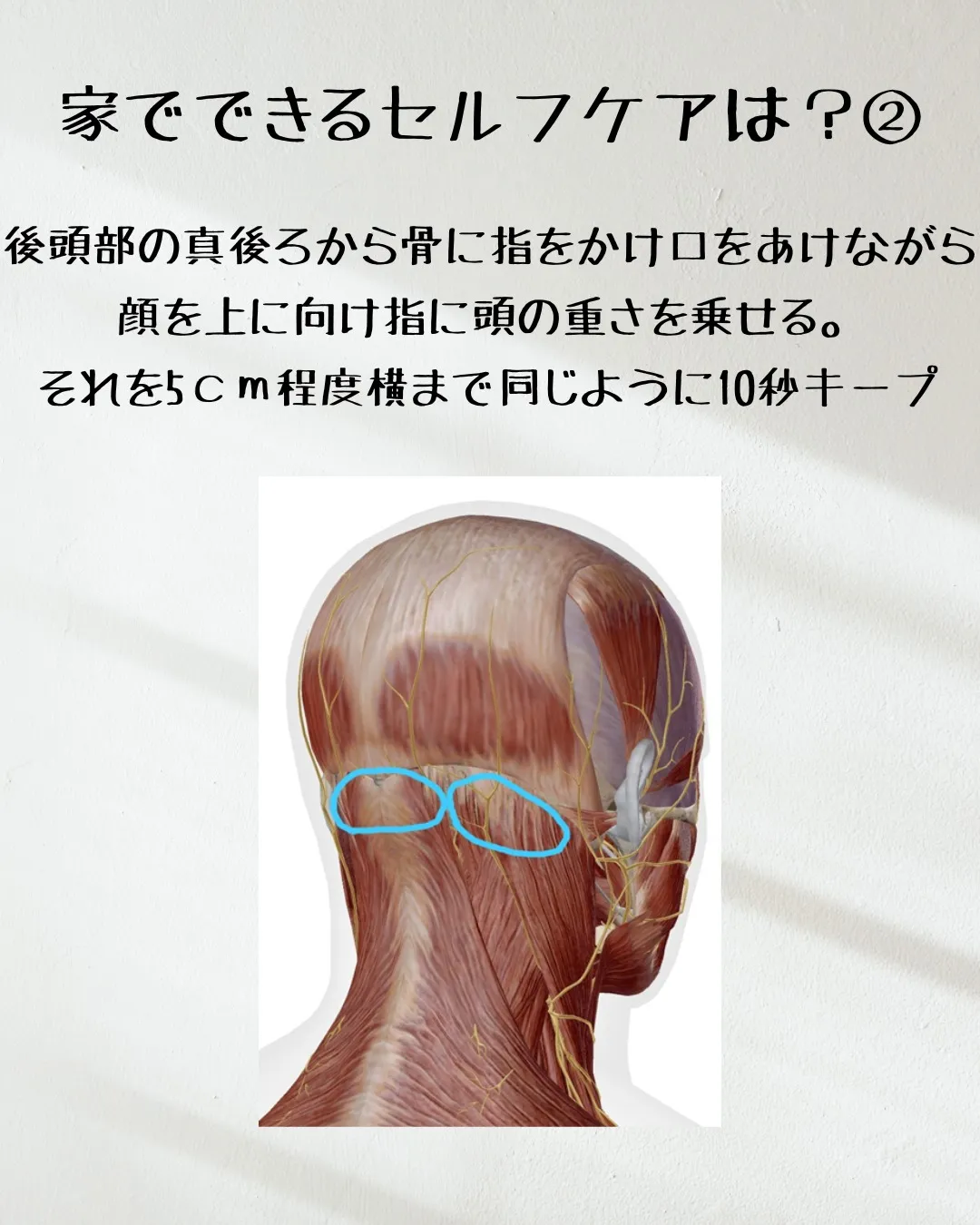 ≪頭痛を治すことはできるのか≫